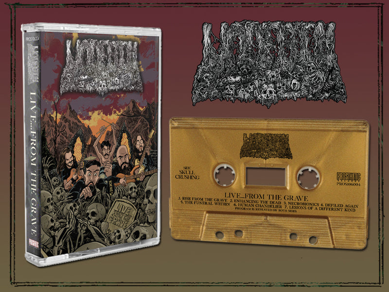 Undeath "Live...From The Grave" Cassette